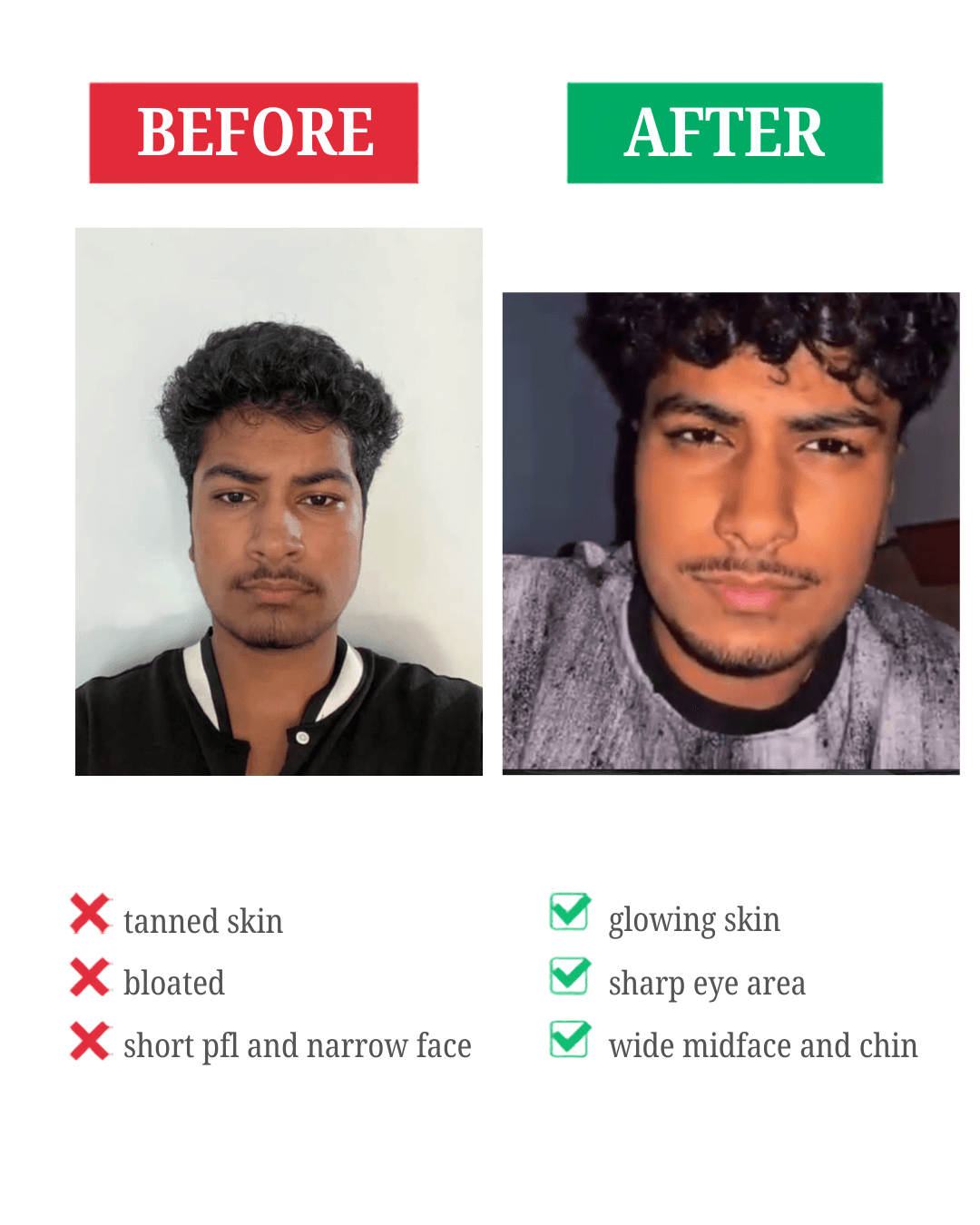 Shumail before and after transformation showing visible changes in skin, facial presentation, and confidence